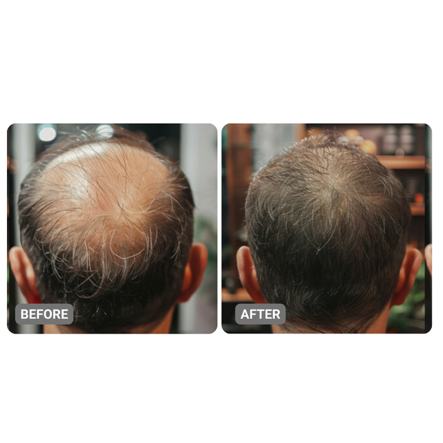 El suero activador de raíz atuendado ™